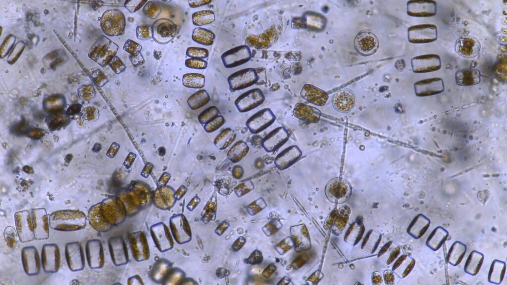 Station11: Phytoplankton seen with the Curiosity microscope – phytoplankton inside a fjord.