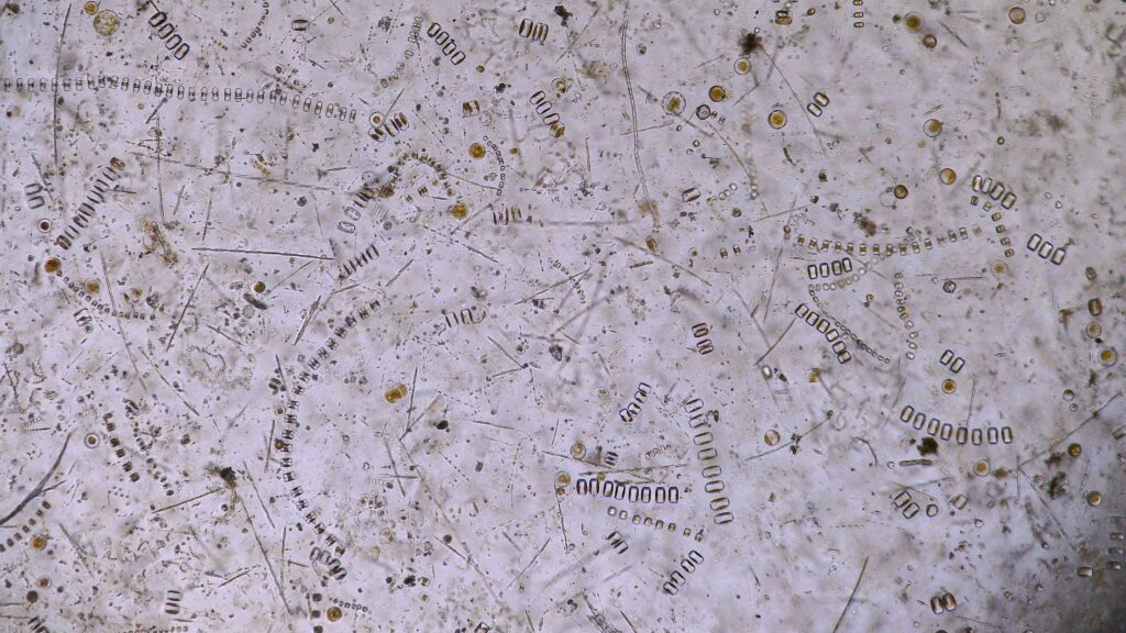 Station 11: High-density phytoplankton sample within a fjord showing both chain-forming centric and pennate diatoms.