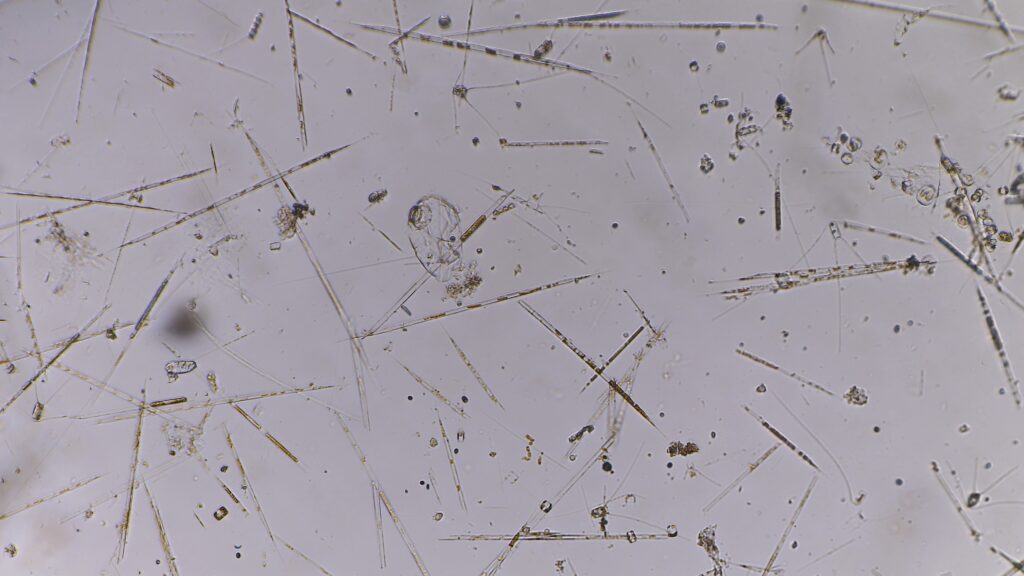 Station 12: Pennate diatoms, Pseudo-nitzschia and Rhizosolenia spp with a few centric chaetoceros spp.