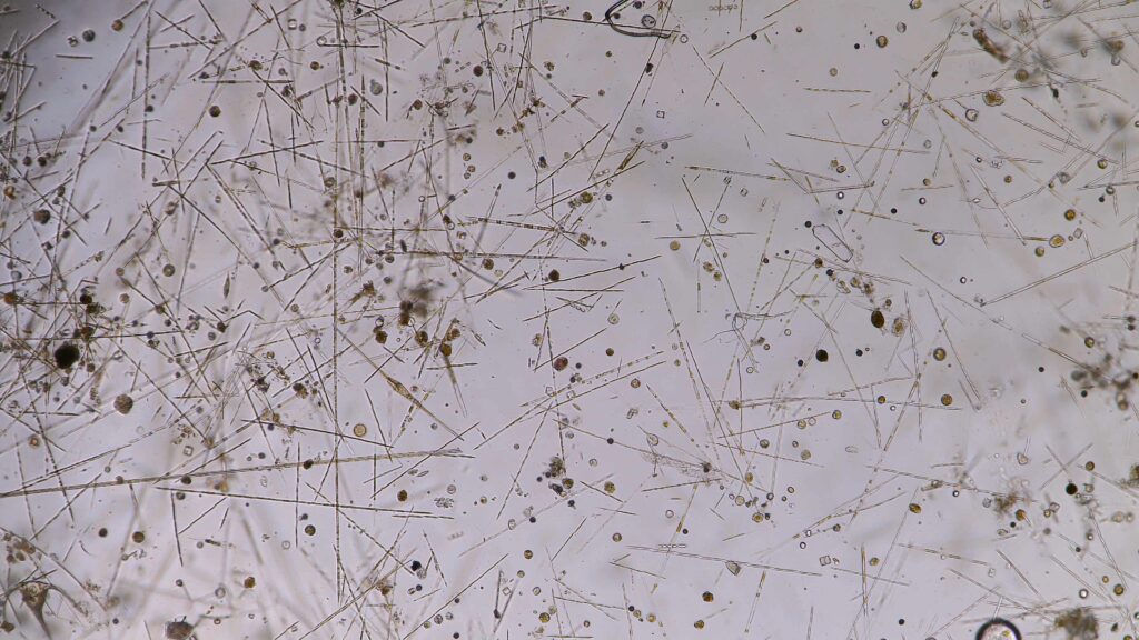 Station 14: High-density pennate diatioms and a few centric diatoms with the appearance of dinoflagellates.