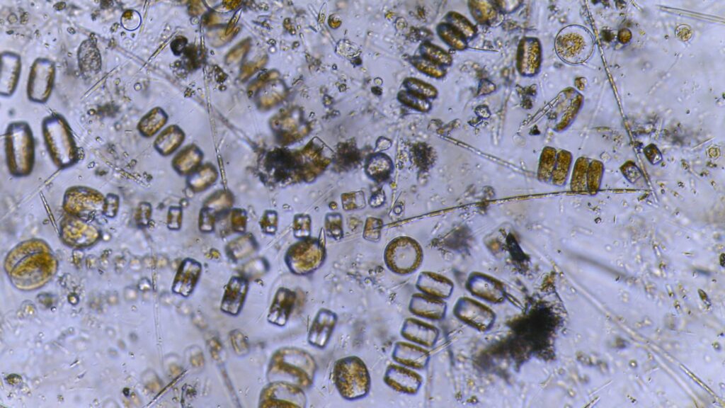Phytoplankton seen with the curiosity microscope: phytoplankton inside the fjord. (Credits: ESA/Ocean Media Lab) An image showing phytoplankton under the microscope, resembling oval and round glass beads on a grey background.