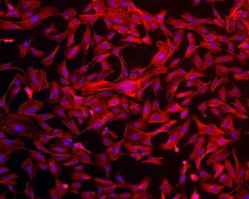 Endothelial cells stained in laboratory. In RED: actin labeled with Phalloidin-550 (Cytoskeleton, USA); in BLUE: nuclear DNA stained with DAPI (Sigma-Aldrich, USA). Credits: Scuola Superiore Sant’Anna, Pisa, Italy