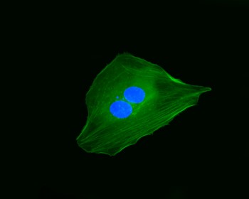 Endothelial cell. In GREEN: actin labeled with Phalloidin-488 (Cytoskeleton, USA); in BLUE: nuclear DNA stained with DAPI (Sigma-Aldrich). Credits: Scuola Superiore Sant’Anna, Pisa, Italy