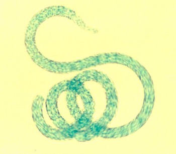 A microscope image of Arthrospira bacteria that are known as Spirulina.