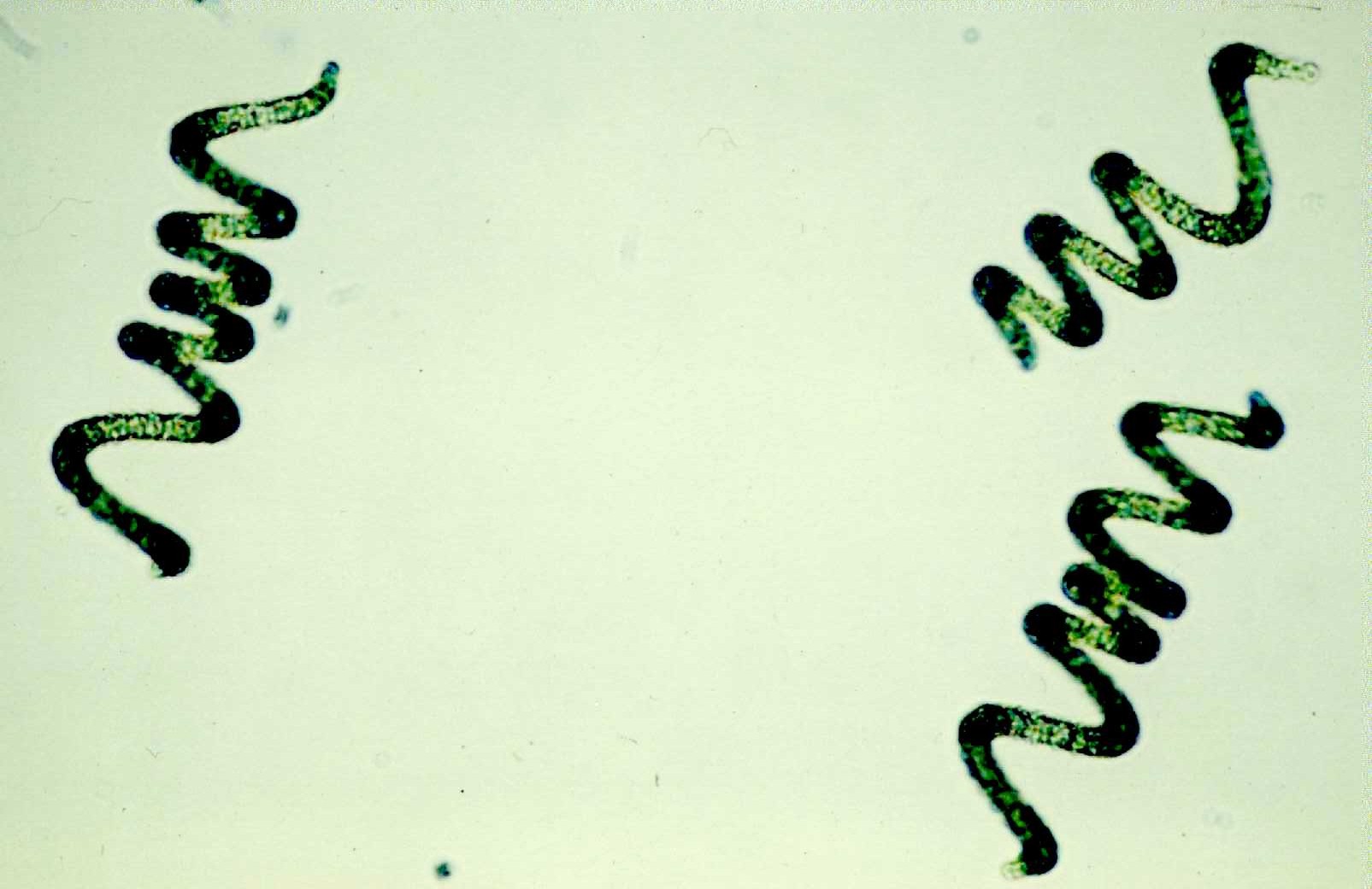 Водоросли белок. Спирулина цианобактерия. Arthrospira водоросли микроскоп. Spirulina микроскоп. Спирулина (Spirulina) под микроскопом.